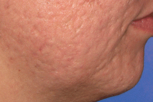 Dermatology Services in St. Louis