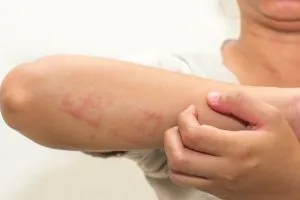 Dermatology Services in St. Louis